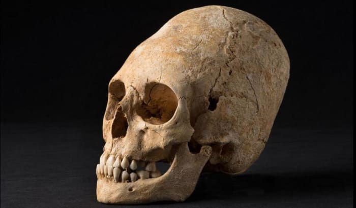 Sydamerikanske stammer ville binde to brædder til et spædbarns kranium, hvilket ville tvinge kraniet til at vokse på en langstrakt måde.