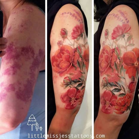 Dette fødselsmærke -cover -up er utroligt og viser utrolig dygtighed fra tatoveringen bag det imponerende kunstfærdighed.