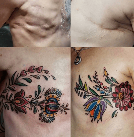 tatuointi, tatuoija, tatuointisuunnittelu, tatuointiinspiraatio, tatuointiidea, rintasyöpä, mastectomy -tatuointi, muste, inkedmag