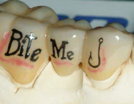 Foto via Platinum Dental Nogle mennesker beslutter at få dem som en