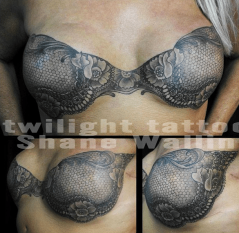 Wallins første tatovering af mastektomi, en sort blonde -bh.
