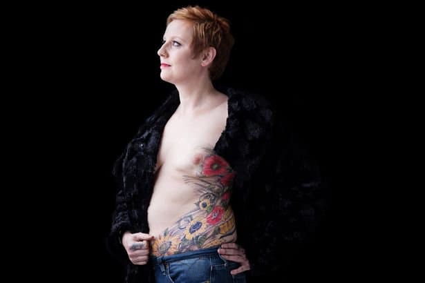(Φωτογραφία: Έρευνα για τον καρκίνο) Αφού αισθάνθηκε αυτοσυνείδητη για τα σημάδια που άφησε πίσω της η μάχη με τον καρκίνο, η Nina Cristinacce αποφάσισε να καλύψει τα σημάδια της με ένα τατουάζ. «Σκέφτηκα ότι μπορεί να με βοηθήσει να συμπαθήσω λίγο περισσότερο, ίσως να αρχίσω να βγαίνω και να νιώθω άνετα με κάποιον ξανά,