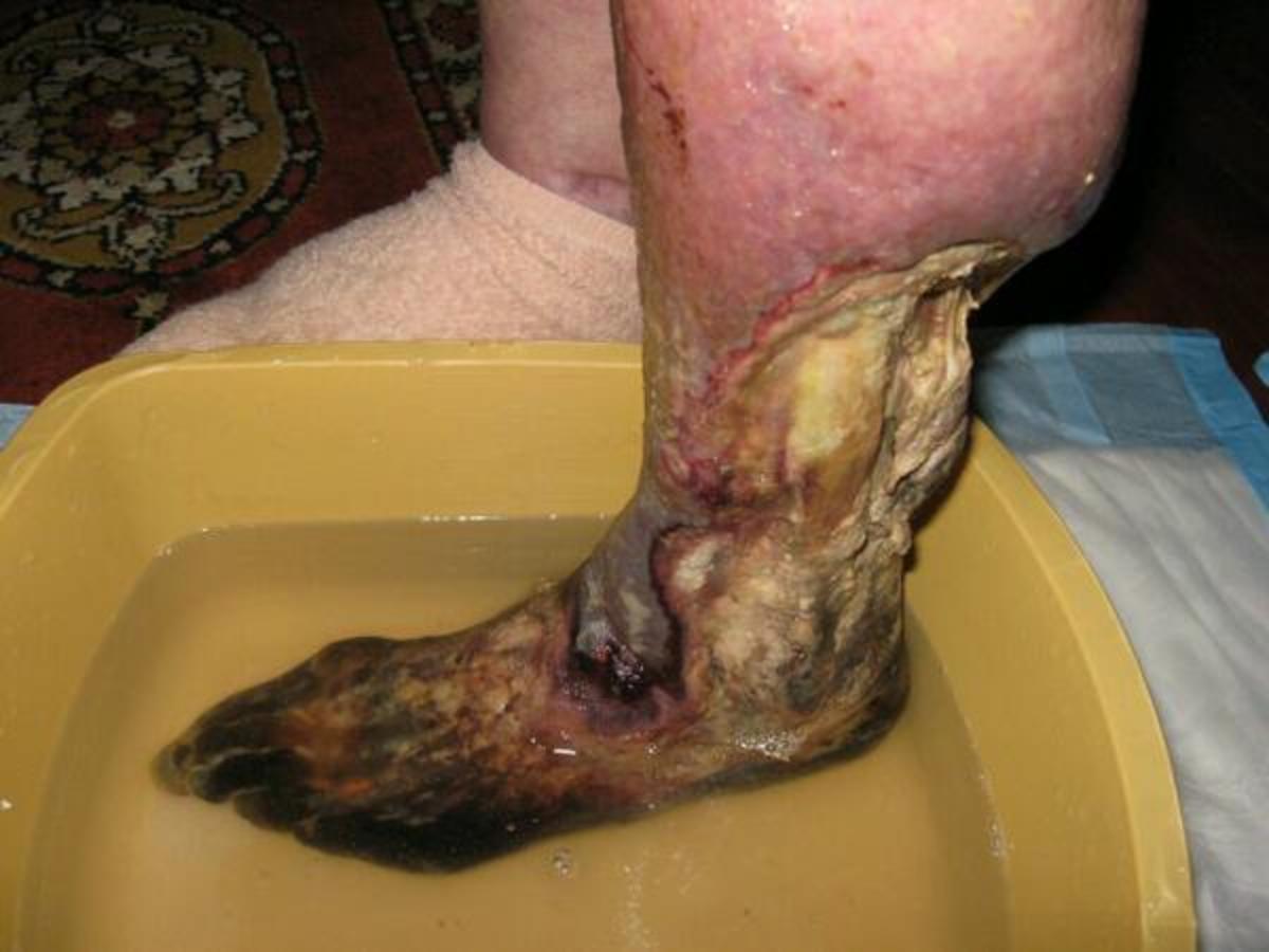 krokodil