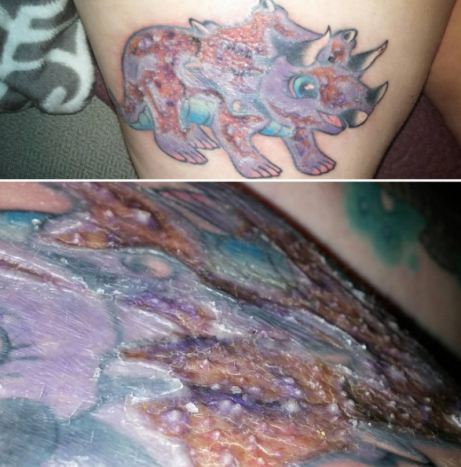 vakavasti tartunnan saanut dinosaurus -tatuointi