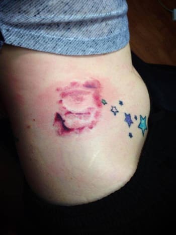 Φωτογραφία μέσω reddit Ένας θαυμαστής του Ted Bundy έκανε πραγματικά το αποτύπωμα των δοντιών του/σημάδια δαγκώματος τατουάζ στο ισχίο της. Χρησιμοποίησε ως σημείο αναφοράς τη φωτογραφία της σκηνής ενός εγκλήματος.