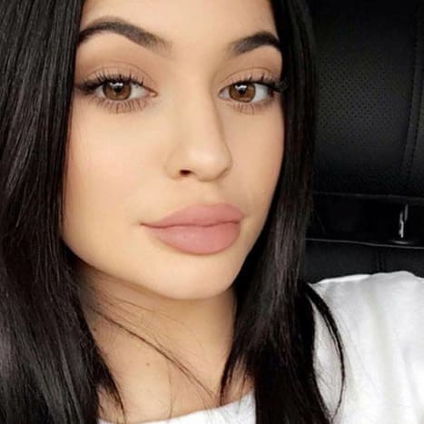 I 2015 indrømmede den yngste Kar-Jenner, Kylie, at have brugt midlertidige læbefyldstoffer på et afsnit af Keeping Up With the Kardashians.