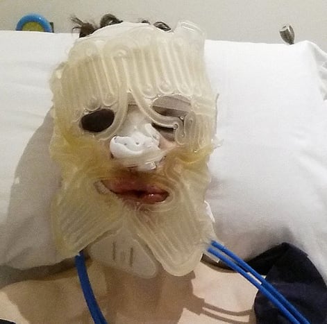 Φωτογραφία μέσω @missxronixΤο 2014, ο Μπλέιντς πήρε το μαχαίρι για μια χειρουργική επέμβαση θηλυκοποίησης του προσώπου που έγινε στη Μαρμπέγια της Ισπανίας.