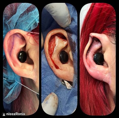 Εικόνα μέσω @missxronixΗ νεότερη τροποποίηση σώματος. μυτερά αυτιά.