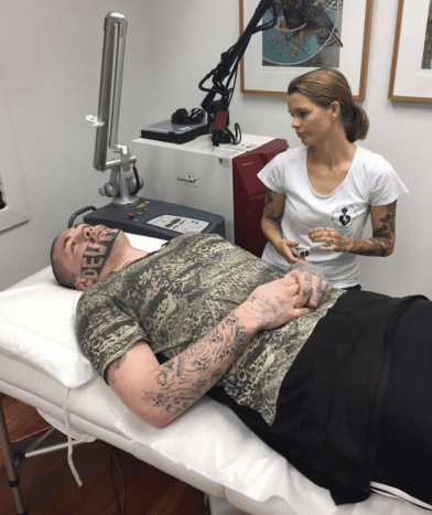 Foto via au.newsBriar Neville ejer af Sacred Laser, der tilbød gratis laserfjerning, kommenterede den potentielle vanskelighed ved at fjerne Cropps tatovering: 