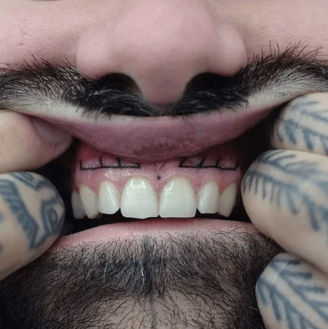 Ως κάποιος που έχει δει ένα άλλο άτομο να κάνει τατουάζ στα ούλα του, αυτό το τατουάζ πονάει περισσότερο από όσο νομίζετε. Εσωτερικό χείλος, κομμάτι κέικ. Αλλά το να κάνεις τατουάζ ακριβώς πάνω από τα δόντια σου είναι μια εντελώς άλλη εμπειρία.