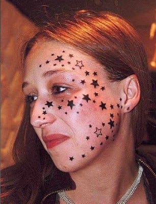 Foto via telegraphKimberley Vlaminck fik til sidst fjernet de 56 stjerner fra venstre side af hendes ansigt.
