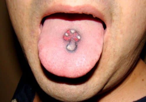 Processen ligner relativt normal tatovering, og det siges at være et af de mindst smertefulde steder at tatovere.